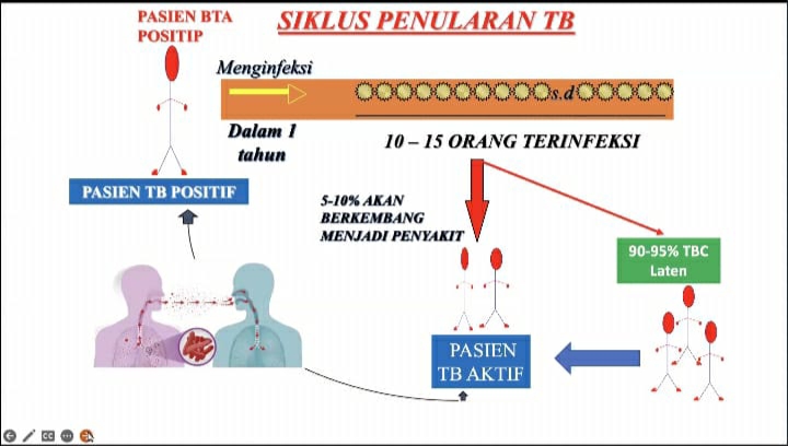 Tuberkulosis (TB) Masih Menjadi Ancaman Kesehatan Dunia