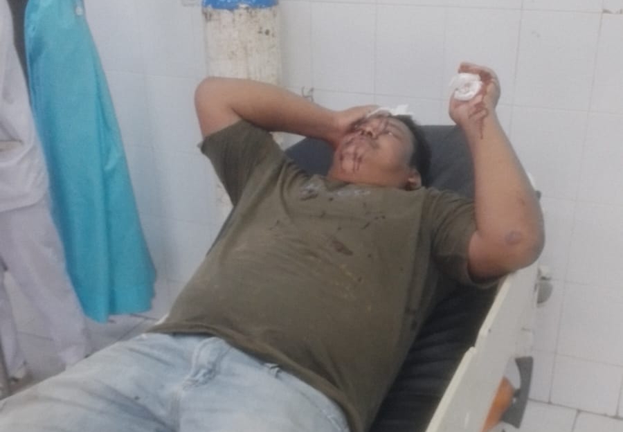 Ratusan Oknum Karyawan PT BSP Lakukan Penganiayaan Massal , Kapolres Asahan Jangan Tutup Mata